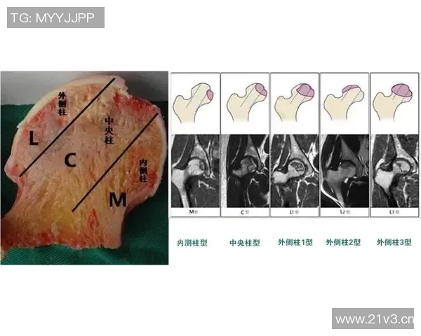 滑板装备选购指南：如何选择适合的护膝保护你的膝盖安全